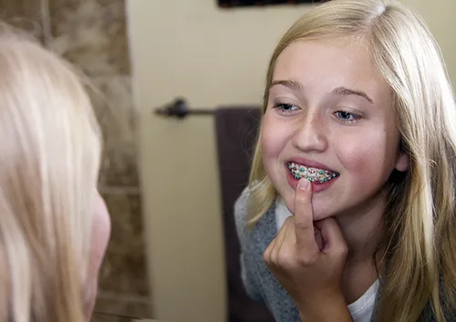 Braces