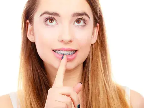 Young woman with metal braces smiling and pointing to her teeth during orthodontic treatment.