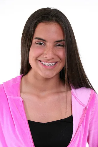 Going Beyond Braces