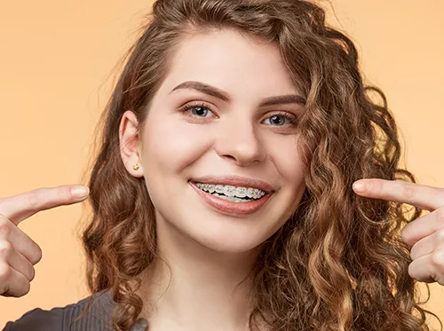 Should I get Braces