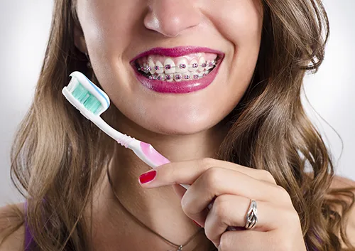 brushing brackets