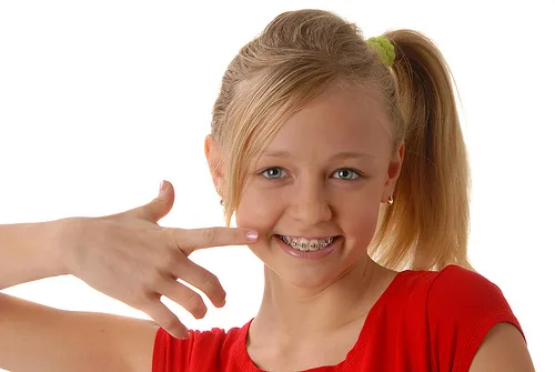 how braces move teeth