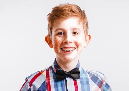 Red-haired nerd with braces and glasses on a white background.