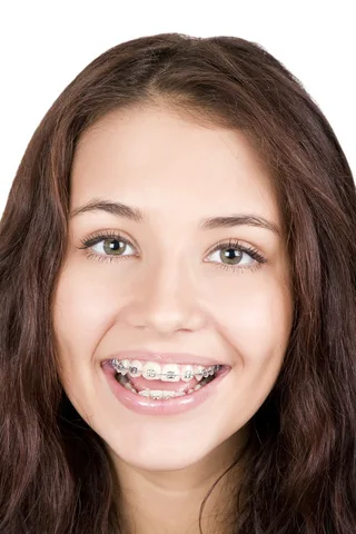 wpid-ortho-girlinbraces