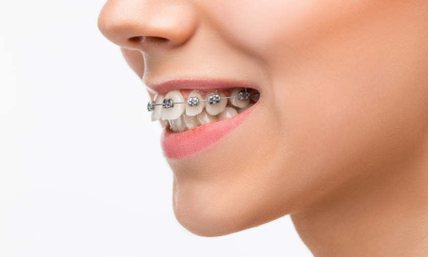 Emergency Orthodontic Care