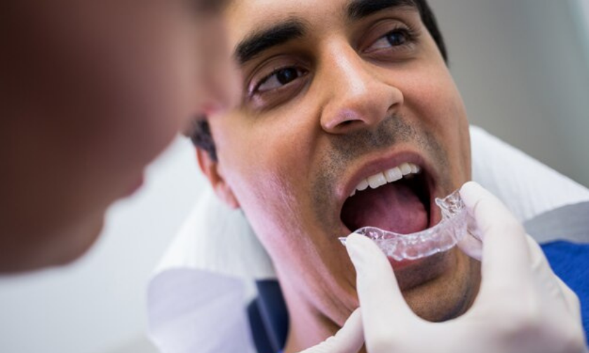 Invisalign For Adults