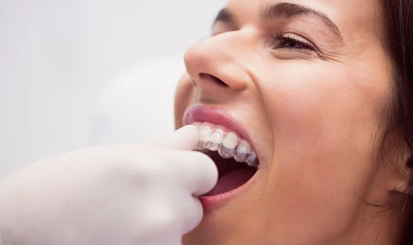 Invisalign Treatment