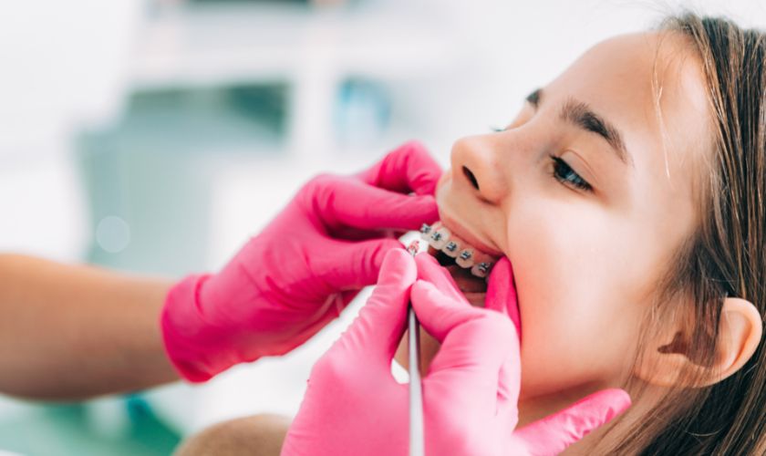 Braces for Teens in Arlington TX