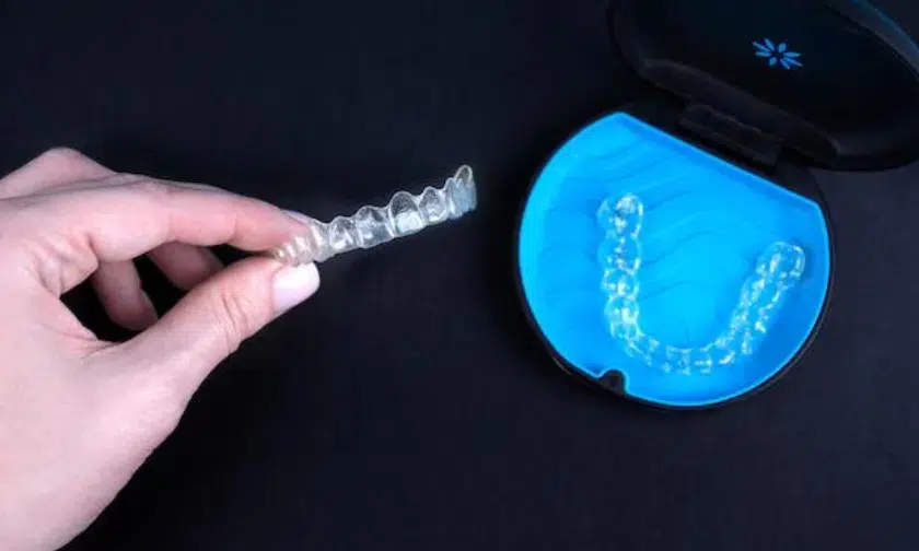 Hand holding orthodontic wire next to blue dental model on dark background.