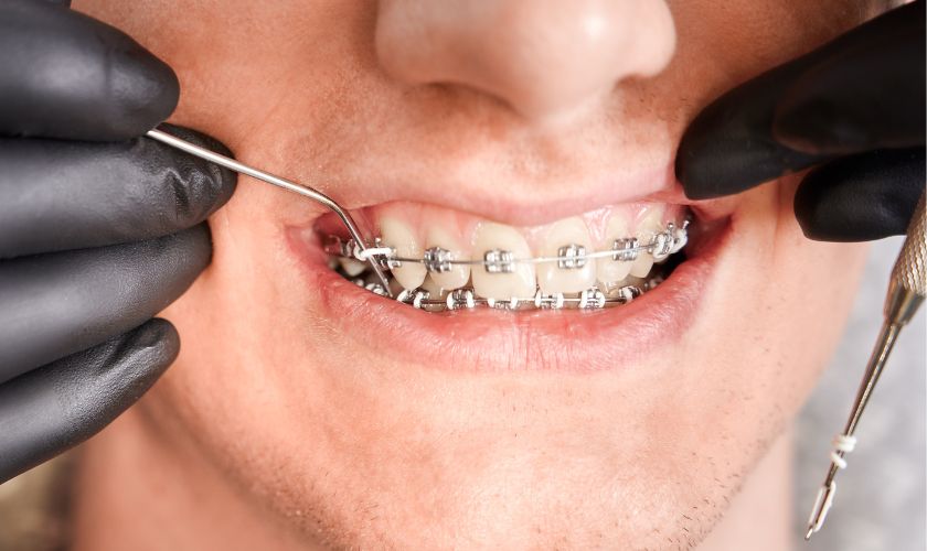 Orthodontics in Arlington