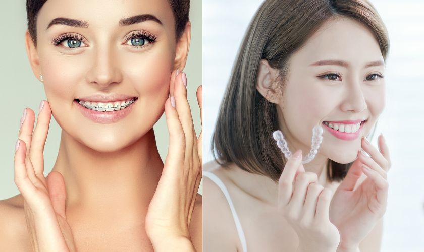 Braces and Invisalign treatment in Arlington- Hildebrand Orthodontics