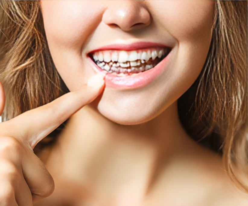 Young woman smiling brightly while pointing to her braces with her finger.