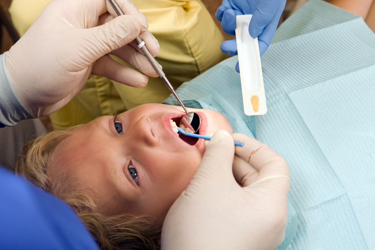 fluoride treatment